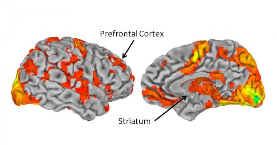 L&#039;amore per la musica studiato con uno scan del cervello